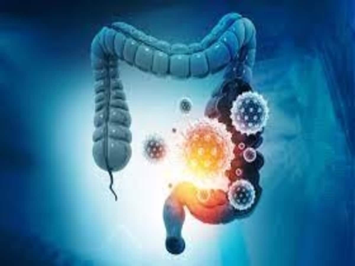 Altered Gut Microbiome Linked To Long-COVID Upto 6-Months Post Recovery, Finds UK Study